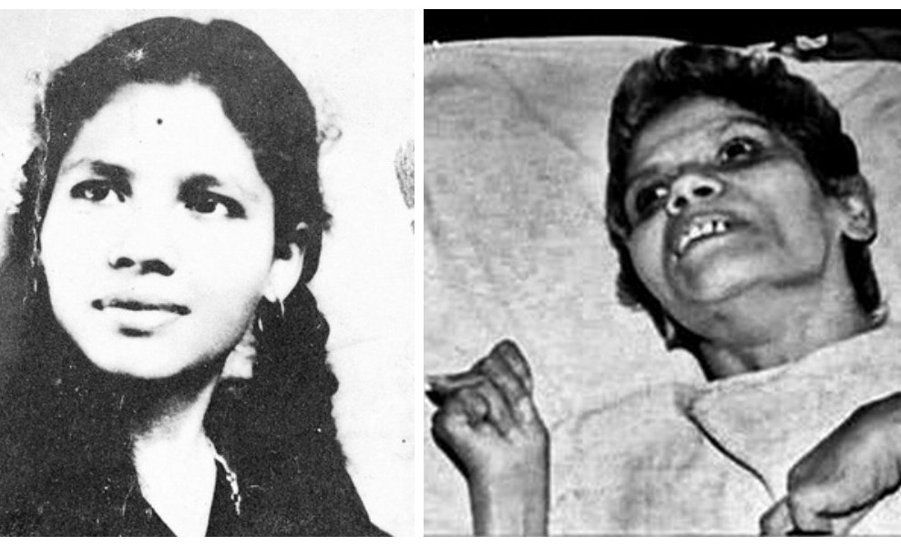Aruna Shanbaug's euthanasia plea was rejected by Supreme Court in 2011 (Photo - PTI/DC) Aruna Shanbaug's euthanasia plea was rejected by Supreme Court in 2011 (Photo - PTI/DC)